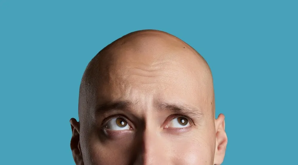 Hair Loss