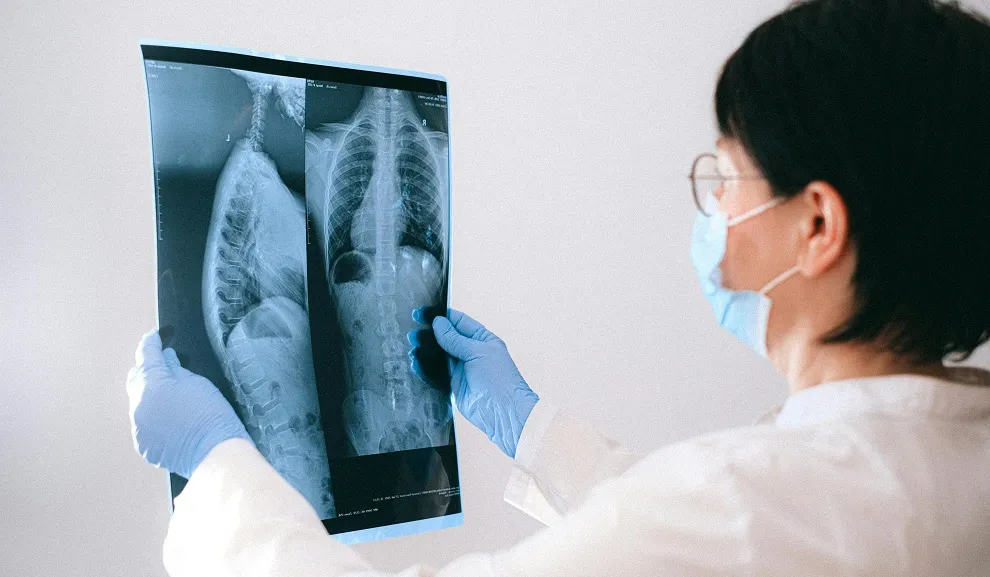 Lung Cancer